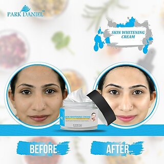 PARK DANIEL Skin Whitening Brightening Cream- Natural Skin Lightner, Dark Spot Corrector & Improves Complexion (50 g) PARK DANIEL Skin Whitening Brightening Cream- Natural Skin Lightner, Dark Spot Corrector & Improves Complexion (50 g)