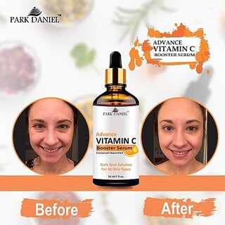 PARK DANIEL Vitamin C Booster Face Serum For Nourished & Bright Skin Pack of 4 30ml (120ml) (120 ml) PARK DANIEL Vitamin C Booster Face Serum For Nourished & Bright Skin Pack of 4 30ml (120ml) (120 ml)