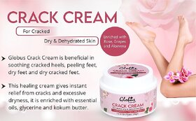 Globus Naturals Crack Cream Rose 100 gm