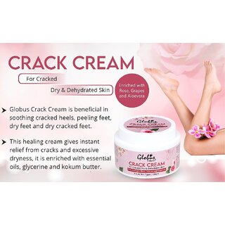                       Globus Naturals Crack Cream For Dry Cracked Heels & Feet,Hand & Elbow | Enriched With Aloevera |Grapes | Rose|Almonds |Lavender                                              