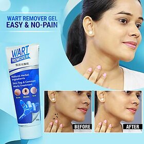 Warts Remover Gel For Men And Women  (100g)