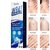 Warts Remover Gel For Men And Women  (100g)