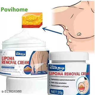 Lipoma Removal Cream Mild Easy to Use Cream Wide Applaications  Mild  Comfortable  Herbal Remedies  Resins 50g
