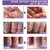 Swipa Nail Serum For Nail Growth Repair Fungal Infection Anti-Infective Re
