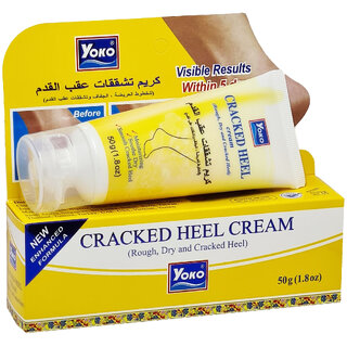 Yoko Cracked Heel Cream (50g) Yoko Cracked Heel Cream (50g)