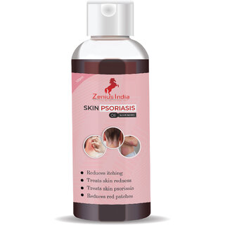Zenius Skin Psoriasis Care Oil Make Healthy Skin Relief From Psoriasis Zenius Skin Psoriasis Care Oil Make Healthy Skin Relief From Psoriasis