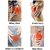 Knee cap Compression Support for Gym Running Cycling Sports Jogging Workout Pain Relief (Material: Nylon & Spandex 1 Pair