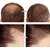 Hairline Powder Stick,Hair Shadow Powder Root Touch Up Powder, Waterproof Hair Shading Sponge Pen Hair Filler Powder For