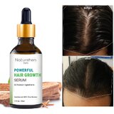 Naturehen Powerful Hair Growth Serum with Chandan  Olive Booster - 30m..