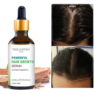                       Naturehen Powerful Hair Growth Serum with Chandan  Olive Booster - 30ml                                              