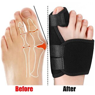 2pcs Soft Bunion Corrector Toe Separator Splint Correction System Device Hallux Valgus Foot Care Pedicure Orthotics 2pcs Soft Bunion Corrector Toe Separator Splint Correction System Device Hallux Valgus Foot Care Pedicure Orthotics