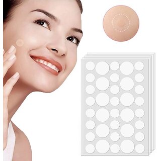 Acne Pimple Patches For Face, Hydrocolloid Dressing Cover, Dots for Spots Pimple Patches, Effectively Calms Relieves Acne Pimple Patches For Face, Hydrocolloid Dressing Cover, Dots for Spots Pimple Patches, Effectively Calms Relieves