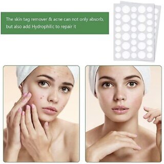                      Acne Pimple Patch-Invisible Facial Stickers cover with 100 Hydrocolloid(18Dots)                                              