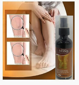 Varicose Veins Spray - Natural Herbal Formula for Fast Relief  Reduces Swelling, Relieves Pain  Promotes Blood Circula