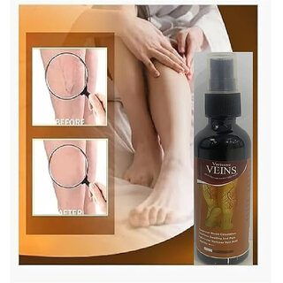 Varicose Veins Spray - Natural Herbal Formula for Fast Relief  Reduces Swelling, Relieves Pain  Promotes Blood Circula