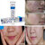 Bioaqua - Acne Top Treatment, Pimple  Scar Removal Clean Clear Skin Anti-Ageing Cream -30g (No of units 1)