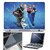FineArts Laptop Skin 15.6 Inch With Key Guard & Screen Protector - Frozen Team
