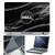 FineArts Laptop Skin 15.6 Inch With Key Guard  Screen Protector - Dell White Rays