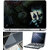 Finearts Laptop Skin 15.6 Inch With Key Guard & Screen Protector - Dark Joker Card