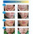 BIOAQUA Anti Acne Cream Treatment Acne Scar Removal Gel Whitening Moisturizing Shrink Pores Beauty Essentials For Face S