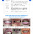 LANBENA 3D White Teeth Whitening Essence Dental Whitener Oral Hygiene White Tooth Cleaning Bleaching Serum Remove Plaque